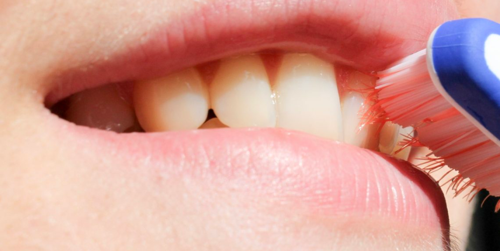 Troppa igiene orale può danneggiare i denti?